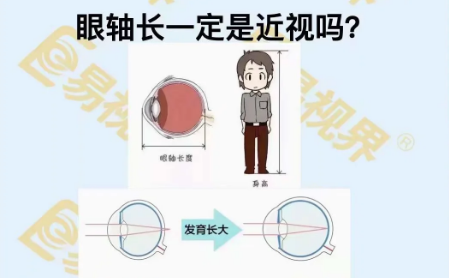 眼軸長一定是近視嗎？