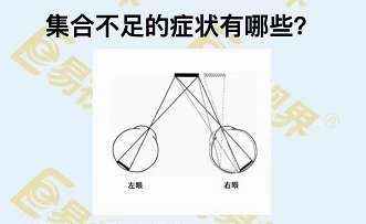 集合不足的癥狀有哪些？